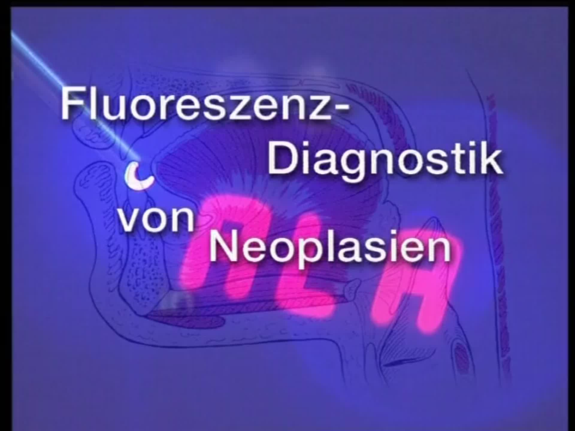 Fluoreszenz Diagnostik von Neoplasien in der Mundhöhle DocCheck