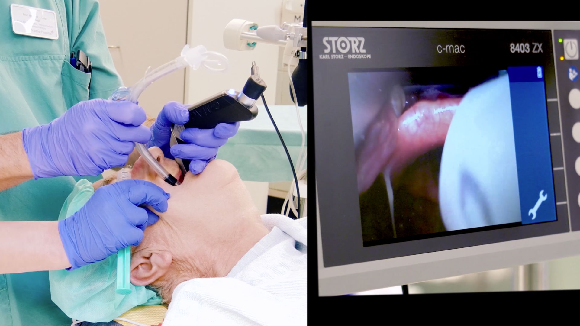 Endotracheale Intubation: So geht's