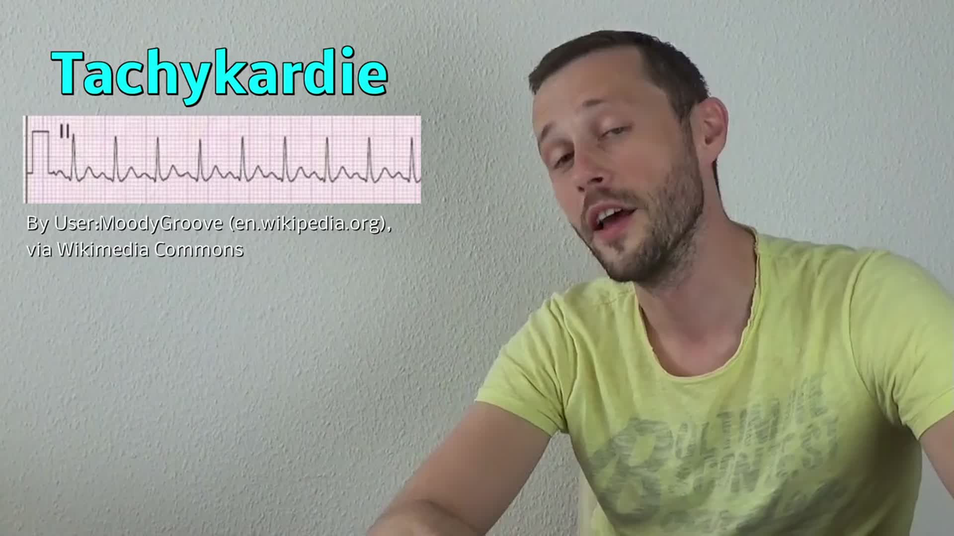 Grundlegendes zur Tachykardie DocCheck